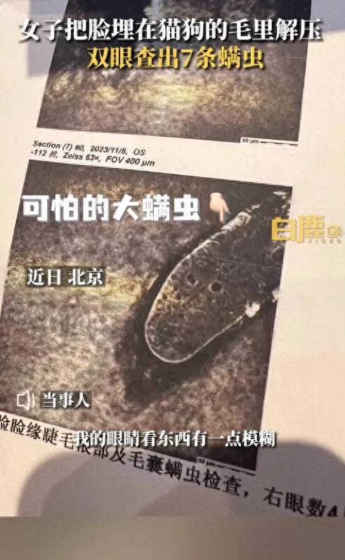 女子爱吸猫狗 把脸埋毛里致眼睛长7条螨虫 当事人：当时感觉看东西模糊检查才发现 以后要注意用眼卫生