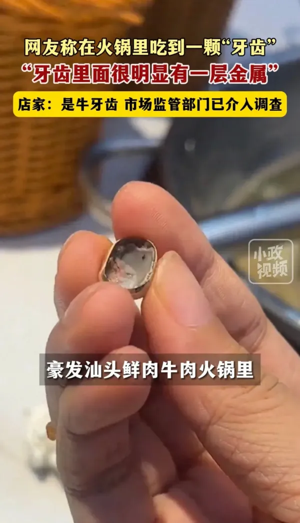 店大欺客 女子就餐吃到牙齿 店家称是牛的牙 监管介入